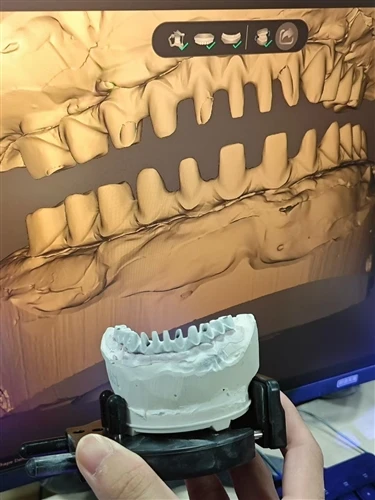 Dental Laboratory Desktop Scanner Performance Showcase