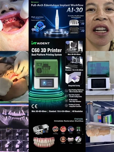 AIDENT—Your Digital Dentistry Full Workflow Solution!feedback Of Real Patient Of Vietnam!